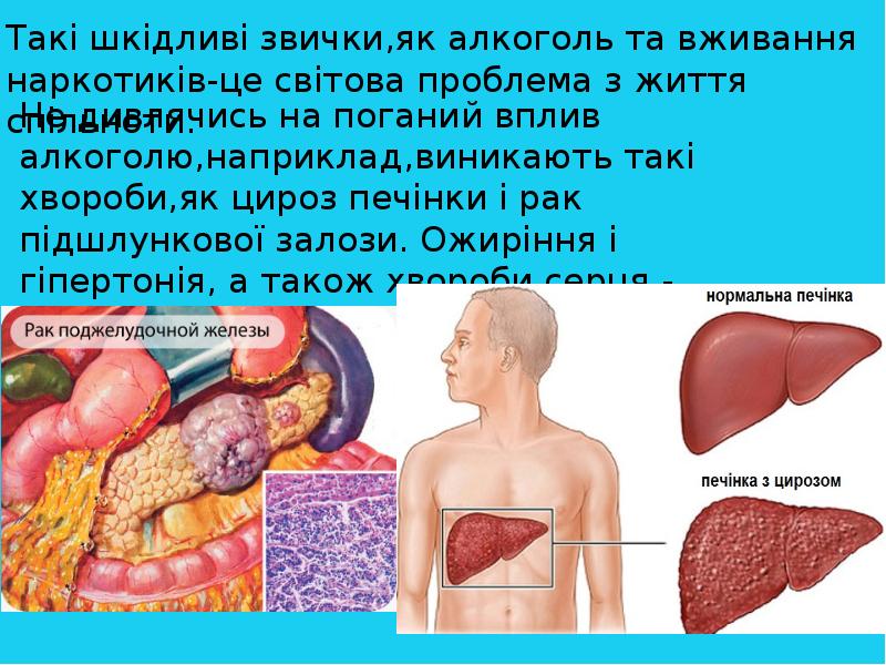 Такi шкiдливi звички,як алкоголь та вживання наркотикiв-це свiтова проблема з життя Такi шкiдливi звички,як алкоголь та вживання наркотикiв-це свiтова проблема з життя