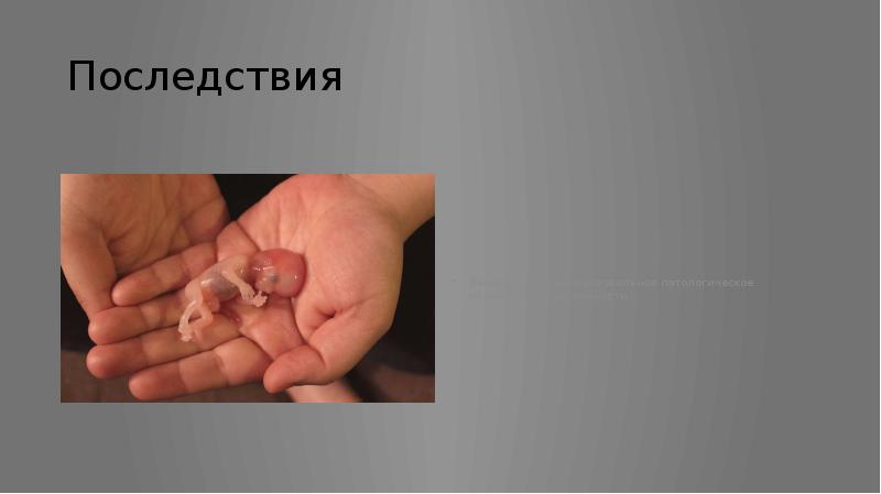 Последствия
Выкидыш— самопроизвольное патологическое прерывание беременности. Последствия
Выкидыш— самопроизвольное патологическое прерывание беременности.