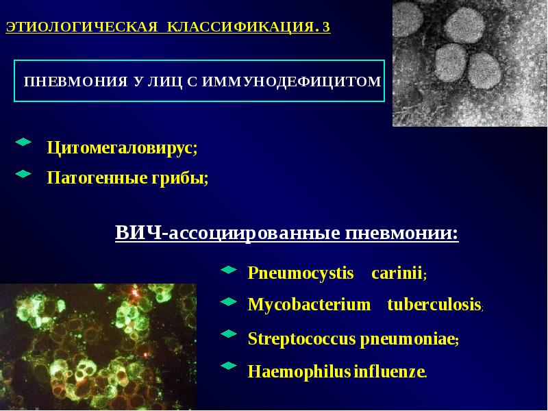 Пневмония презентация кратко