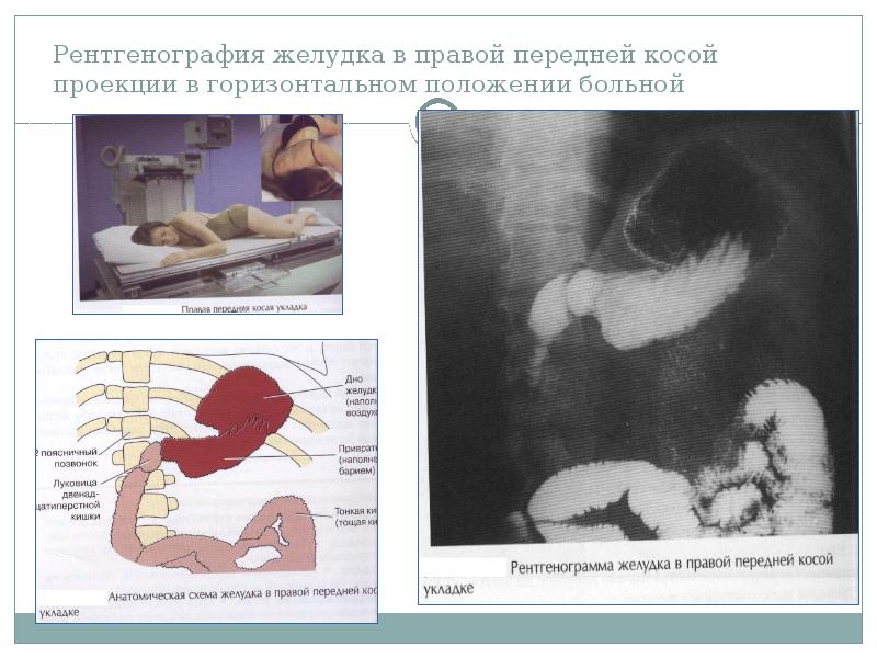 Рентгенография желудка презентация