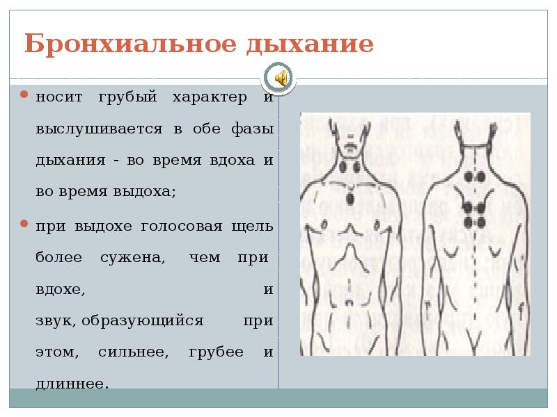 Бронхиальное дыхание выслушивается