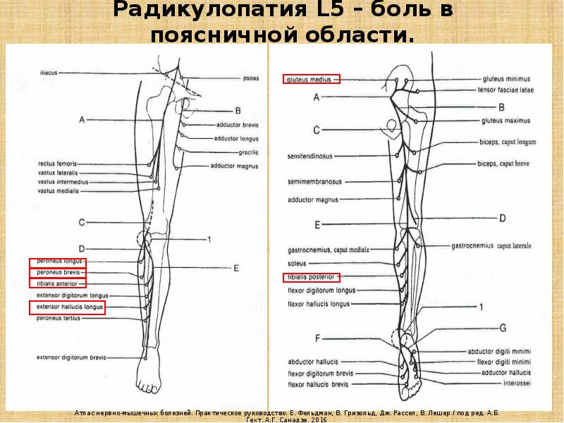 Радикулопатия. Радикулопатия л 4 справа. Радикулопатия Корешков л5 с1. Радикулопатия л5 с1 симптомы. Радикулопатия пояснично-крестцового.