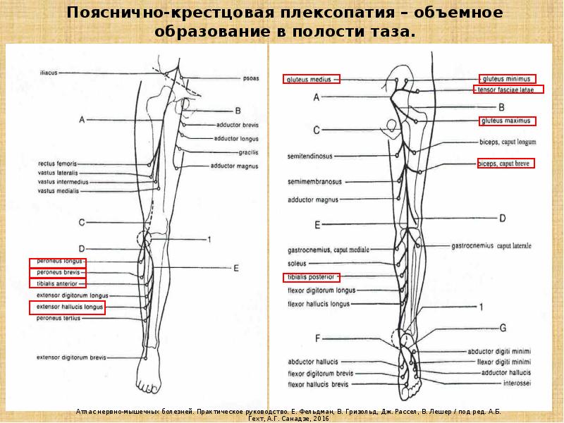 Карта вызова радикулопатия пояснично крестцового