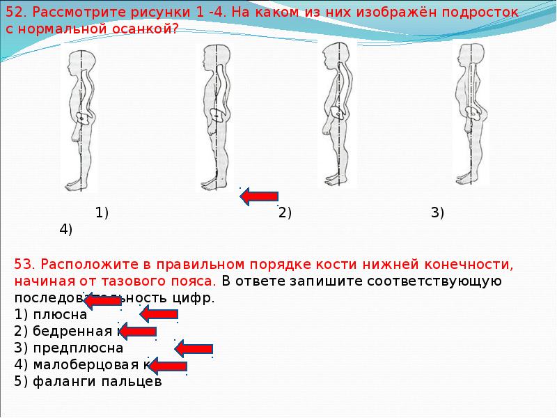 Рассмотрите рисунки 1 3. Правильный порядок костей нижней конечности. Расположение в правильном порядке кости нижней конечности. Подросток с нормальной осанкой. Типы осанки человека ОГЭ.