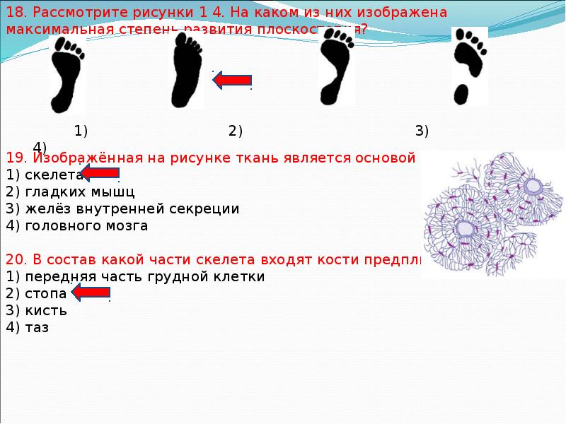 4 рассмотрите рисунки 1 2 3. Изображенная на рисунке ткань является основой скелета. Изображённая на рисунке ткань является основой. Изображённая на рисунке ткань является основой 1 скелета. Изображённая на рисунке ткань является основой головного мозга.