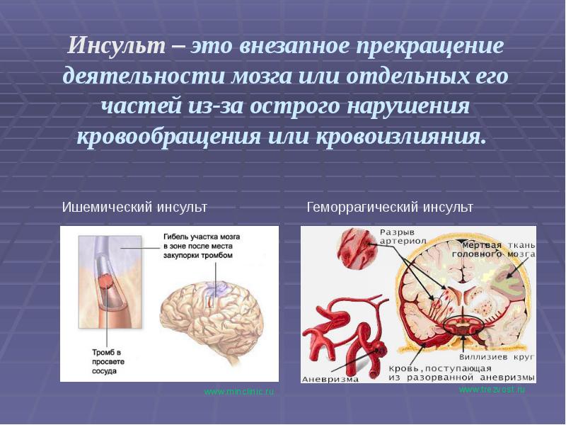 Первая помощь при острой сердечной недостаточности проект