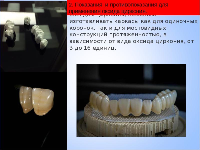 Презентация cad cam в стоматологии