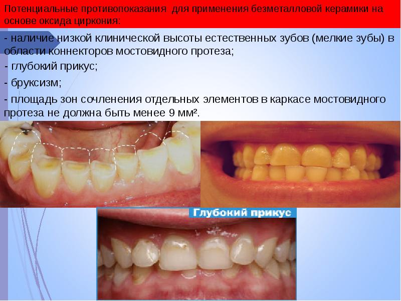 Клинический случай по ортопедической стоматологии презентация