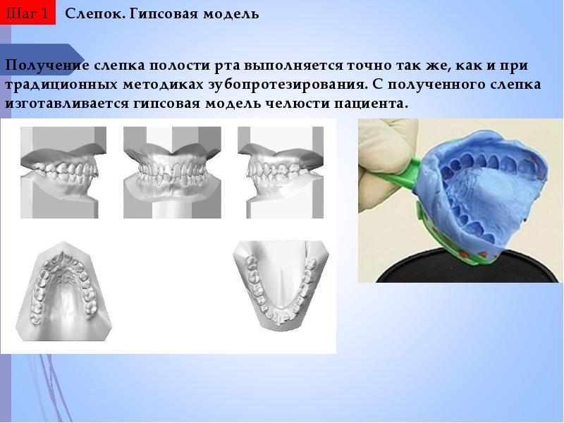 Cad cam технологии в ортопедической стоматологии презентация