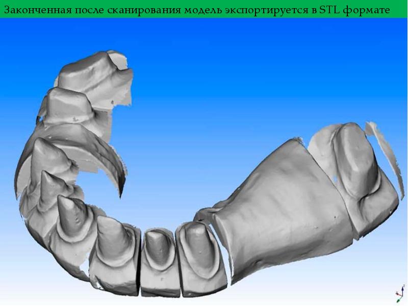 Cad cam технологии в ортопедической стоматологии презентация