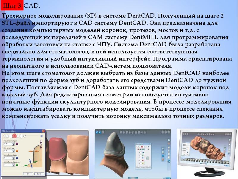 Cad cam технологии в ортопедической стоматологии презентация