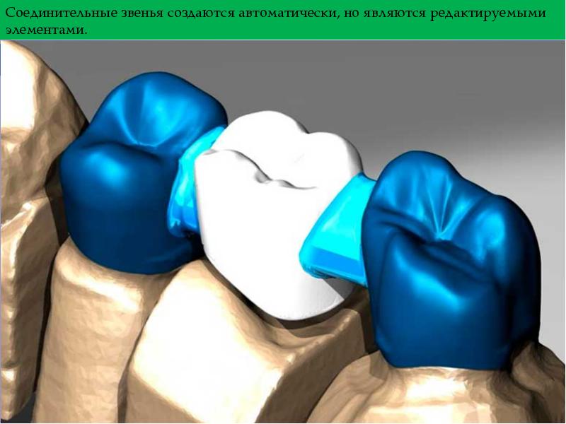 Cad cam технологии в ортопедической стоматологии презентация