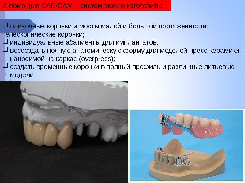 Cad cam технологии в ортопедической стоматологии презентация