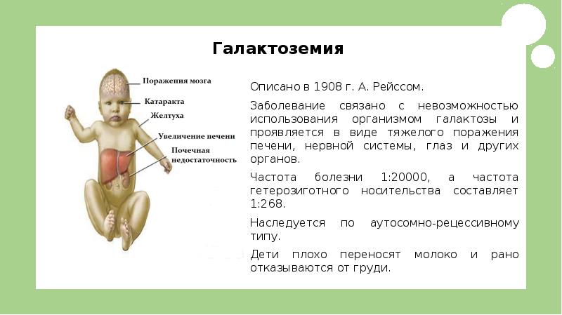 Галактоземия презентация по генетике