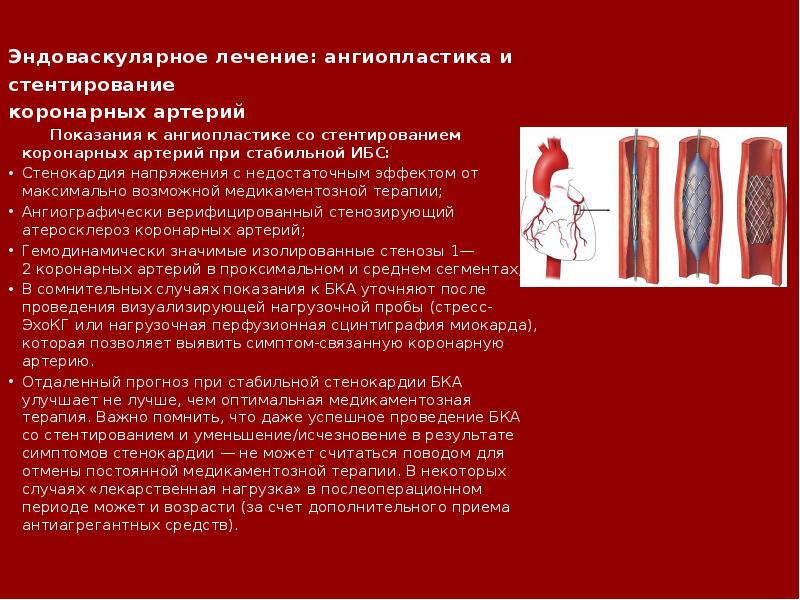 Какие лекарства после стентирования сердца. Какие лекарства после стентирования сердца