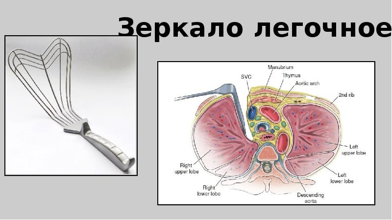 Торакальная хирургия презентация