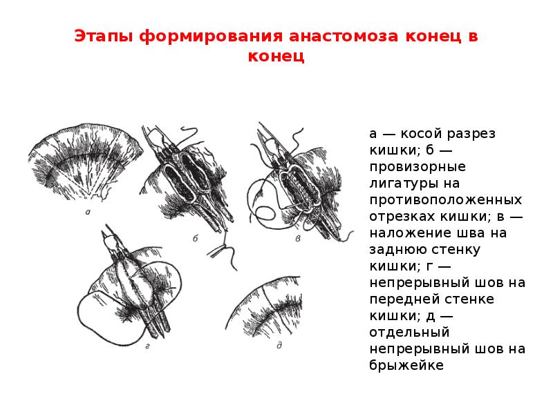 Анастомозы передней брюшной стенки