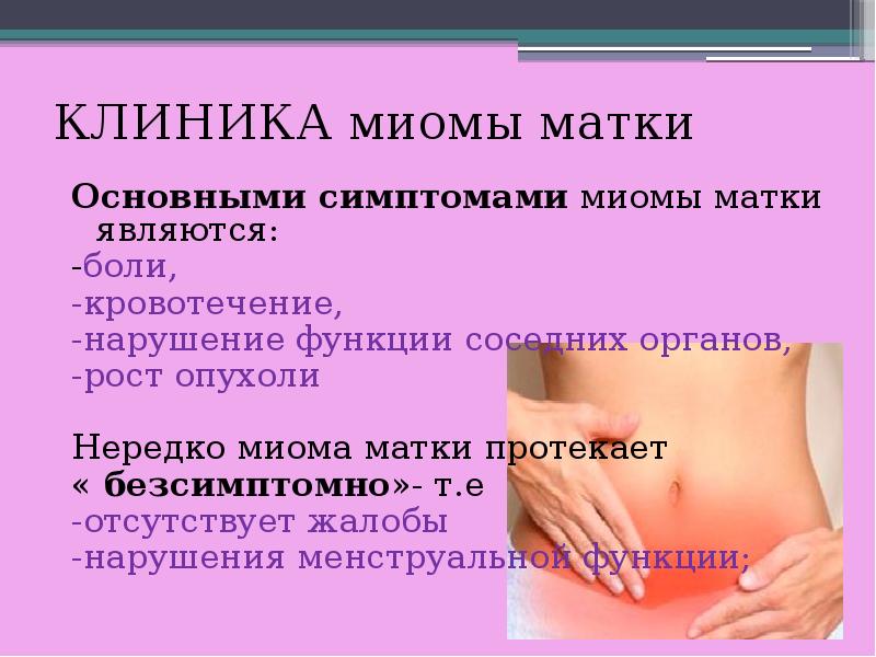 Миома матки презентация гинекология