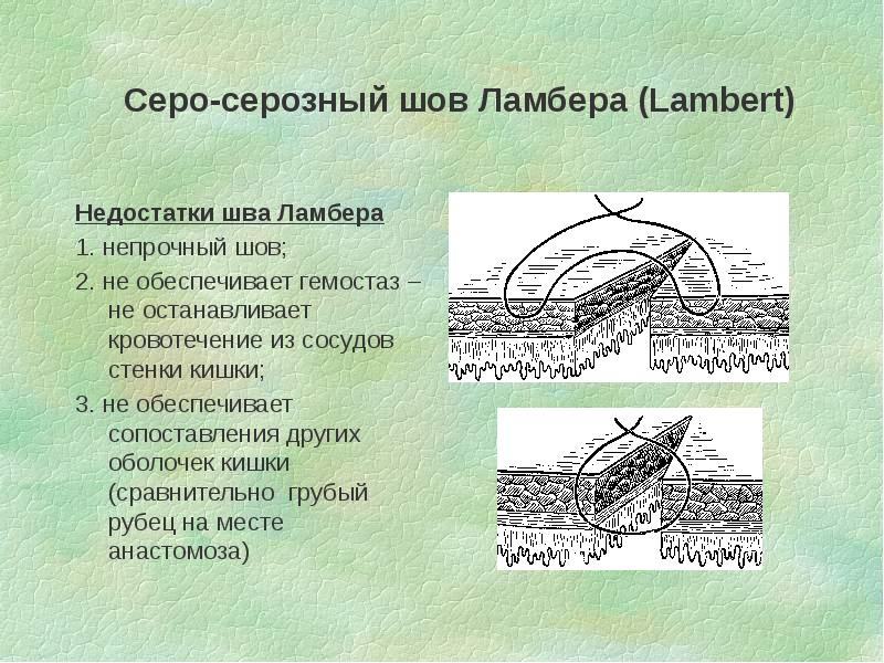 На какой из футляров стенки кишки наложение швов обеспечивает герметичность