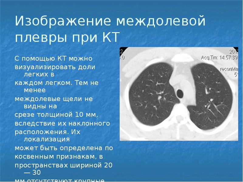 Лучевая диагностика заболеваний легких презентация