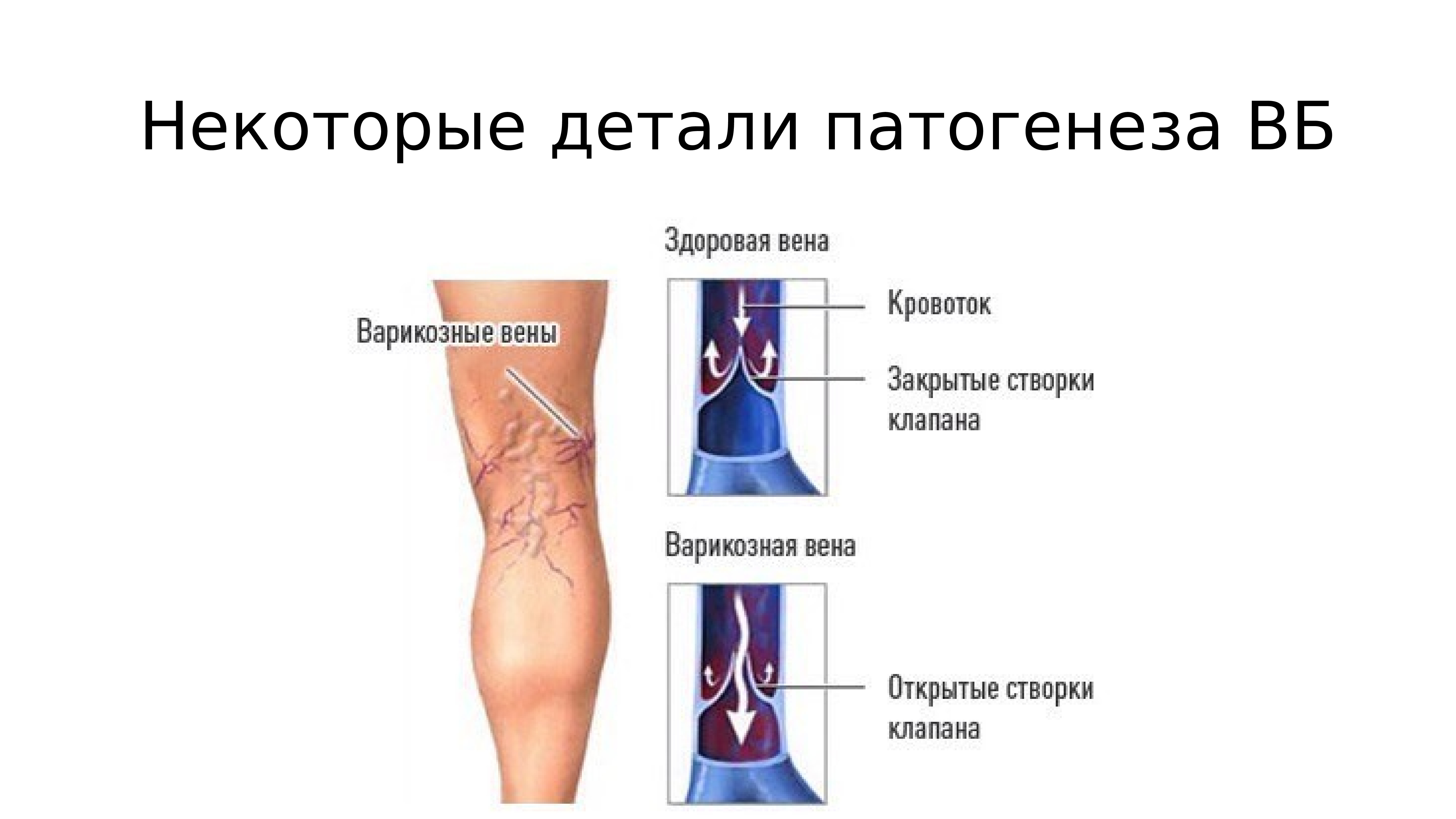 Тромбофлебит карта смп