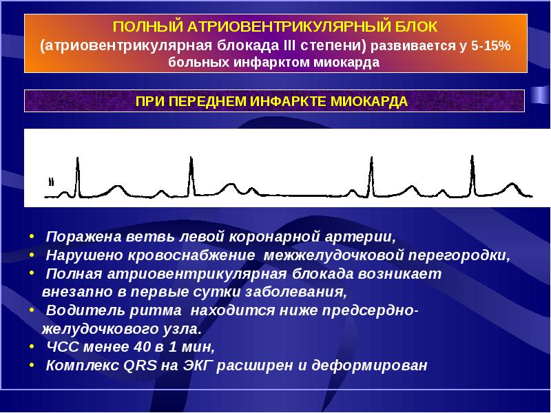 Осложнения инфаркта миокарда презентация