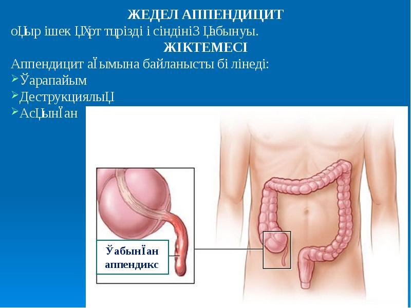 Жедел ішек өтімсіздігі презентация