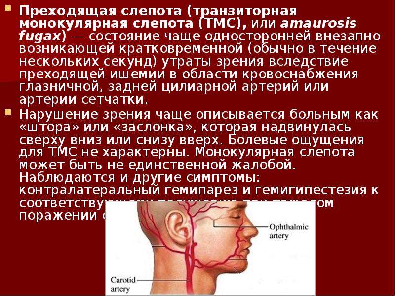 Преходящий. Транзиторная монокулярная слепота. Преходящая слепота (транзиторная монокулярная слепота). Транзиторная потеря зрения. Транзиторная монокулярная амблиопия.