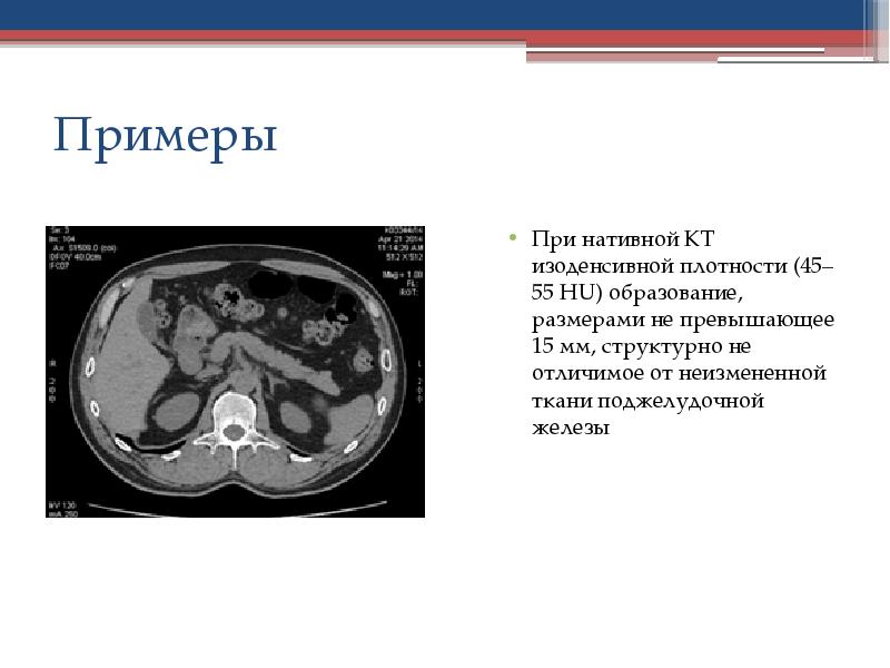 Размеры печени на кт норма