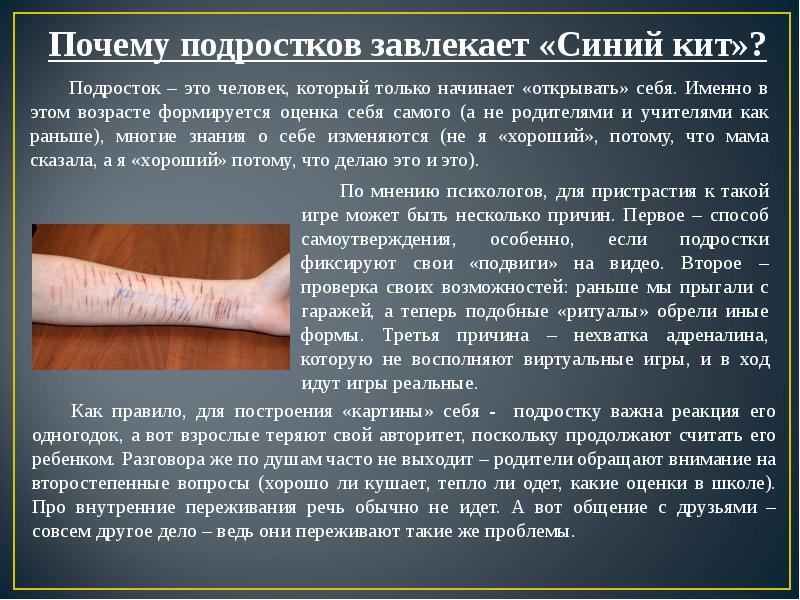 Что Такое Синий Кит Фото Детей