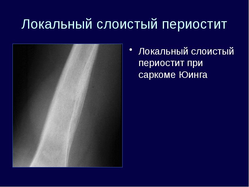 Лучевая диагностика костей презентация