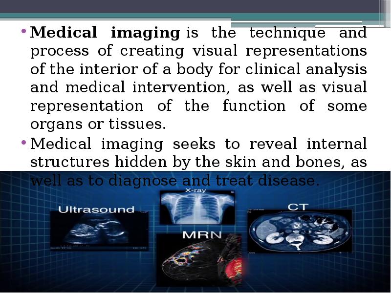 Medical imaging is the technique and process of creating visual representations of Medical imaging is the technique and process of creating visual representations of