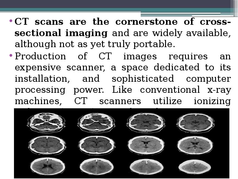 CT scans are the cornerstone of cross-sectional imaging and are widely CT scans are the cornerstone of cross-sectional imaging and are widely