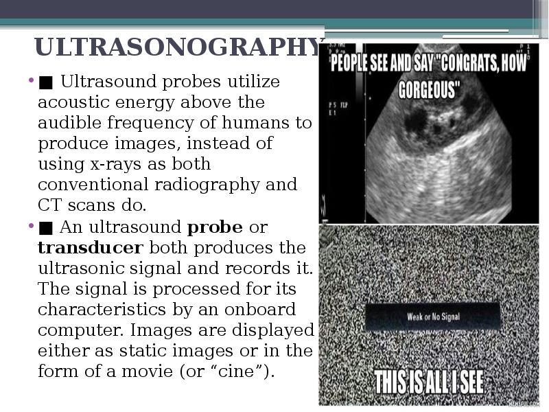 ULTRASONOGRAPHY
■ Ultrasound probes utilize acoustic energy above the audible ULTRASONOGRAPHY
■ Ultrasound probes utilize acoustic energy above the audible