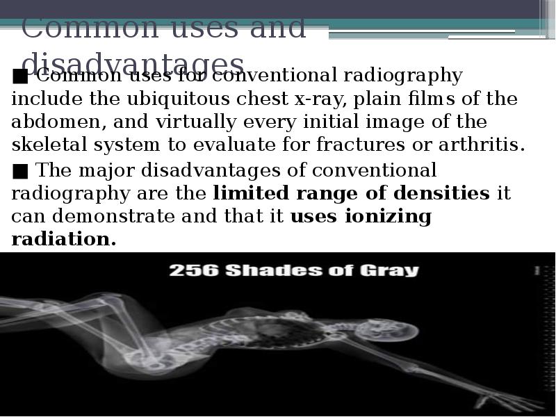 Common uses and disadvantages
■ Common uses for conventional radiography include Common uses and disadvantages
■ Common uses for conventional radiography include