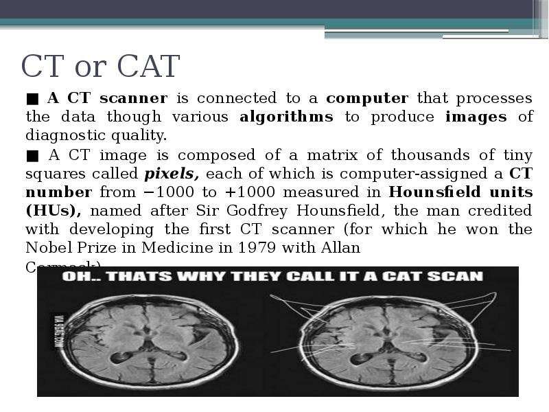 CT or CAT
■ A CT scanner is connected to a CT or CAT
■ A CT scanner is connected to a