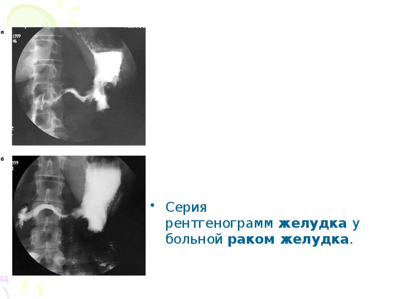 Схема описания рентгенограммы желудка