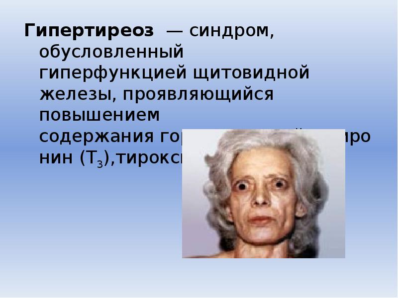 Гипер функция. Гипер функция