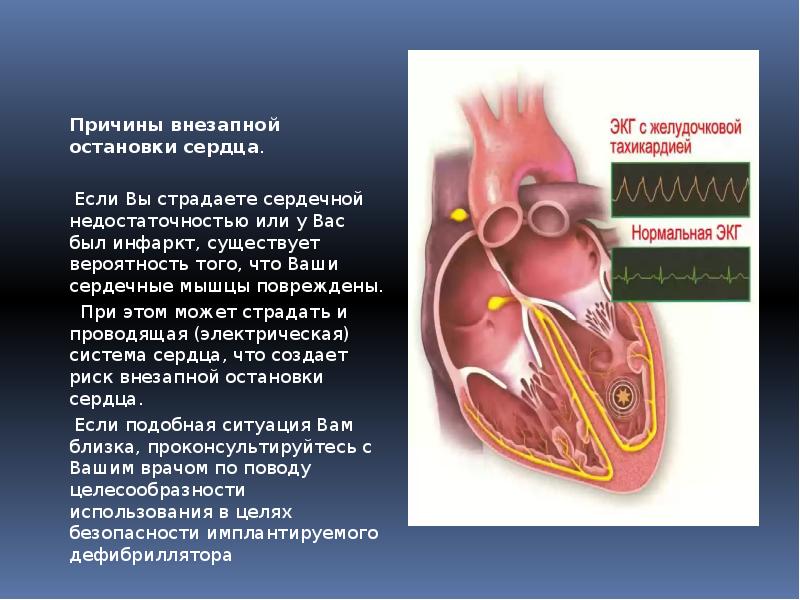 Причины внезапной остановки сердца.  Причины внезапной остановки сердца. &nbsp; 