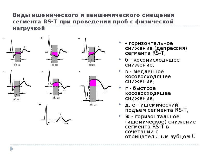 Смещение st