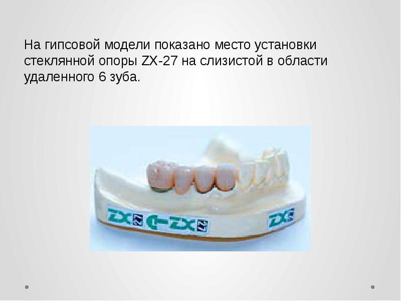 Хирургическая стоматология. Удал 6. Дистопированный зуб мудрости рентген. Удал 6. Удал 6.
