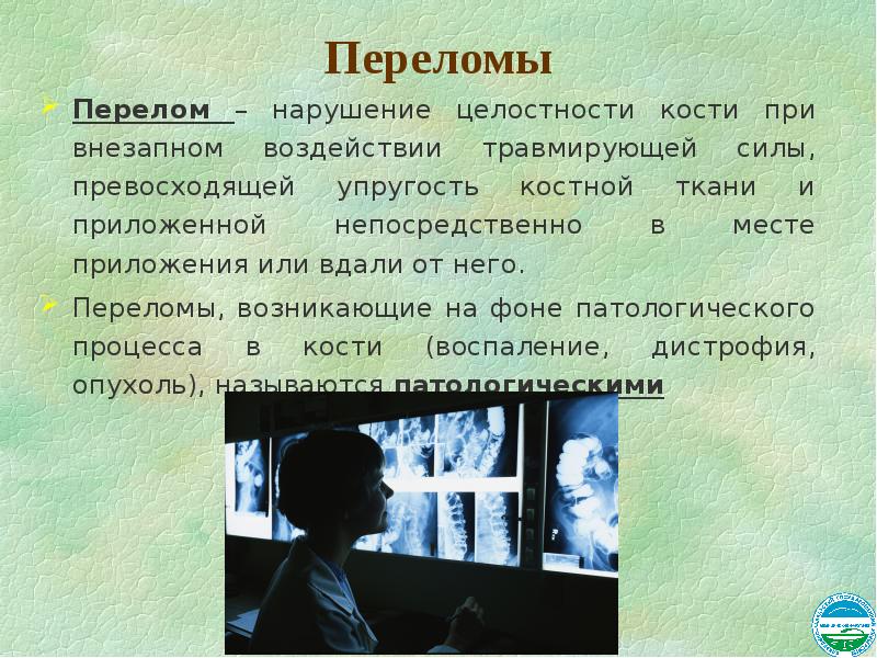 Почему в 1609 году произошел перелом. Травмы общая хирургия презентация. Нарушение целостности кости. Нарушение целостности костей происходит при. Место приложения травмирующей силы.