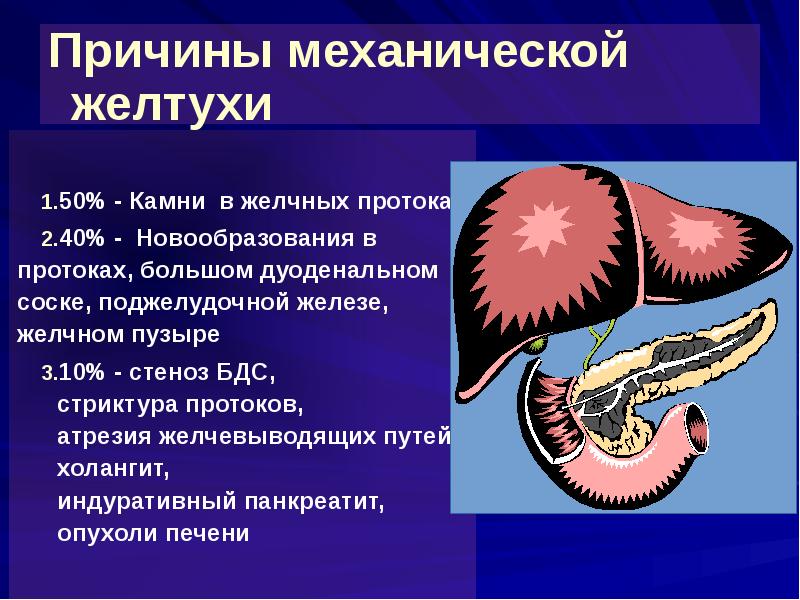 Тест механическая желтуха. Механическая желтуха лекция. Причины механической желтухи. Ультразвуковые признаки механической желтухи. Обтурационная желтуха симптомы.