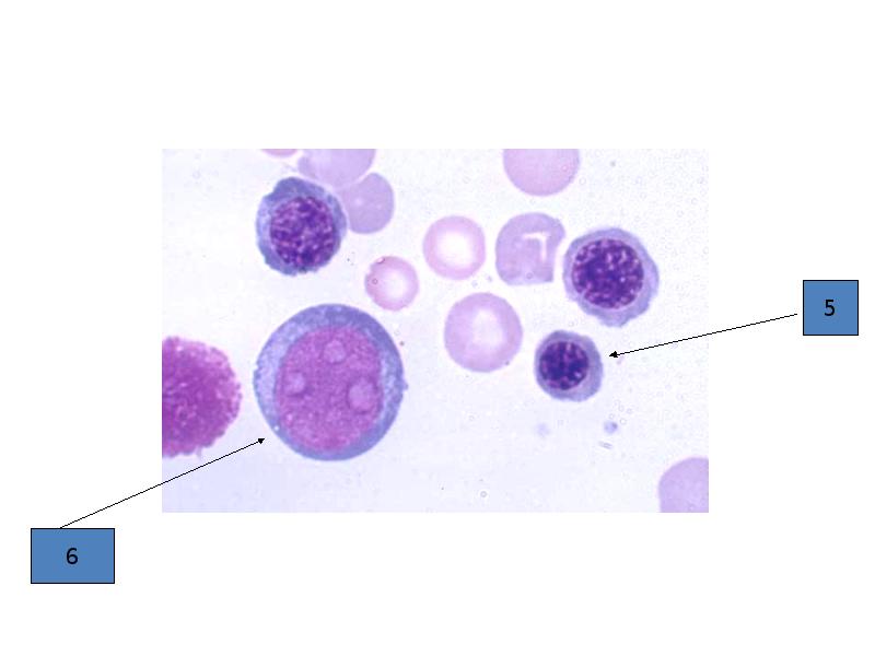 7 гематология. Презентация по гематологии. Тельца Курлова гематология. Шаблон по гематологию.