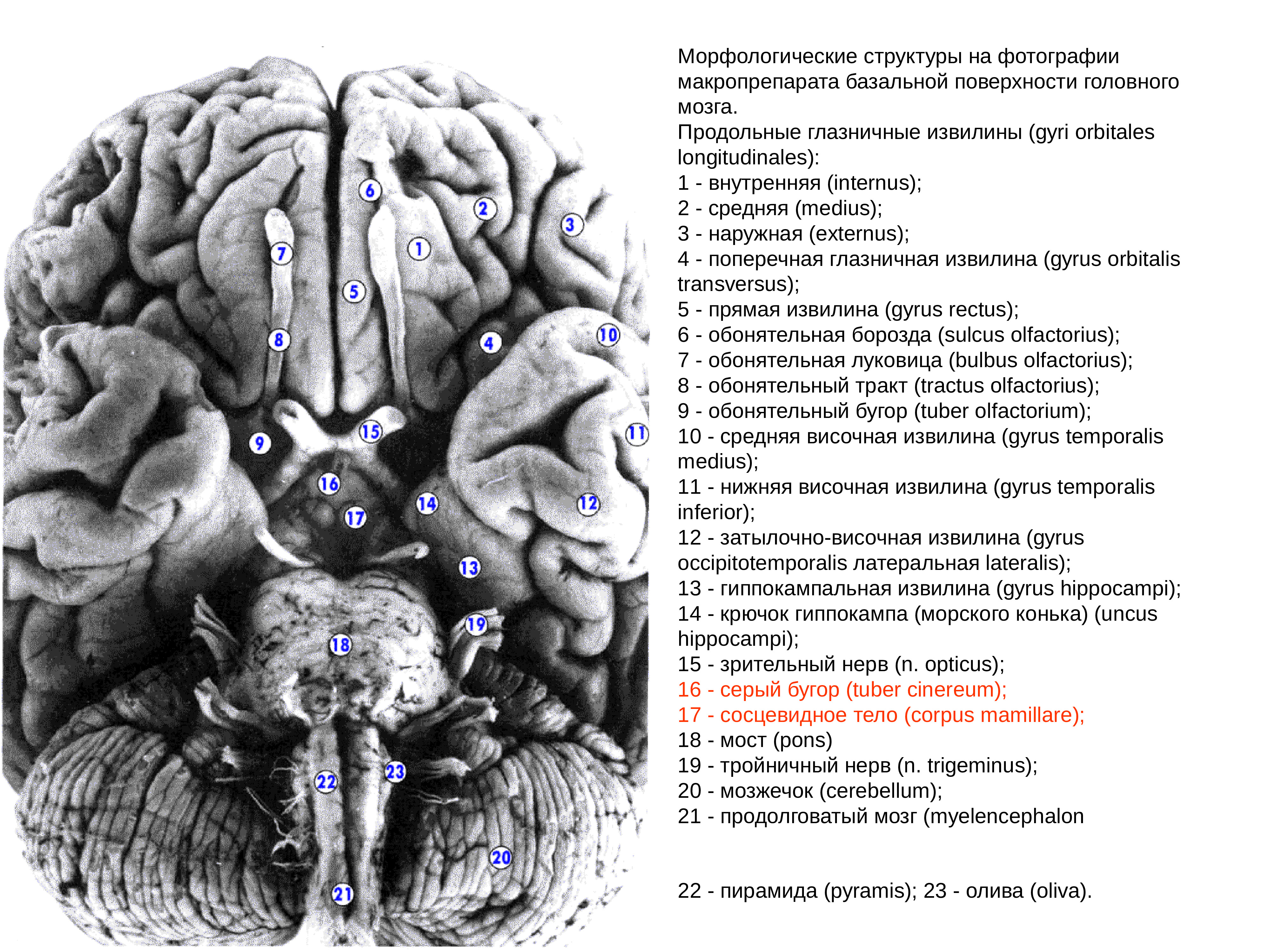 Серый мозг латынь. Базальная поверхность головного мозга борозды. Строение головного мозга вид снизу. Базальная поверхность головного мозга извилины. Базальная поверхность головного мозга анатомия.