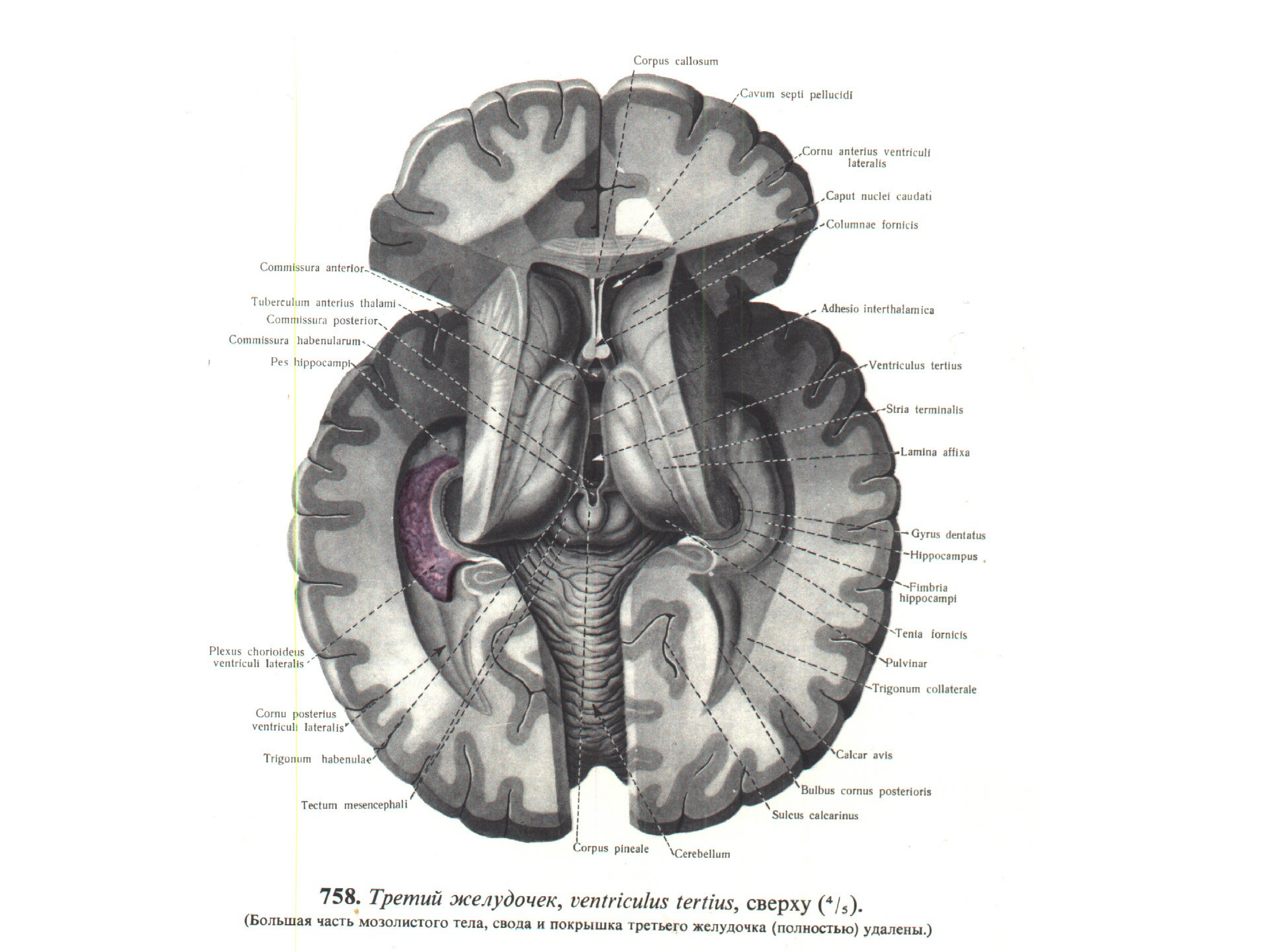 4 желудочек рисунок. 3 Желудочек мозга анатомия. Третий желудочек анатомия строение. Третий желудочек промежуточного мозга. III желудочек, ventriculus Tertius.