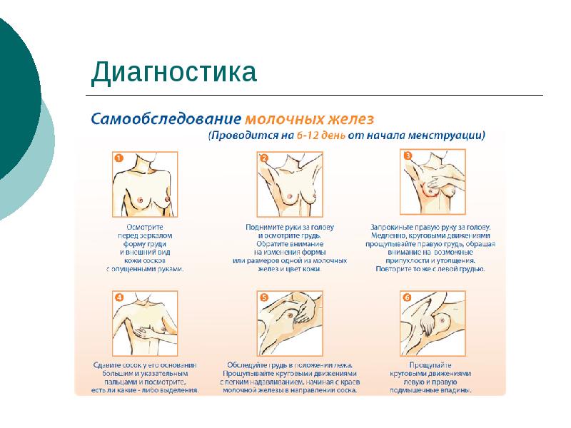 Рак молочной железы самообследование картинки