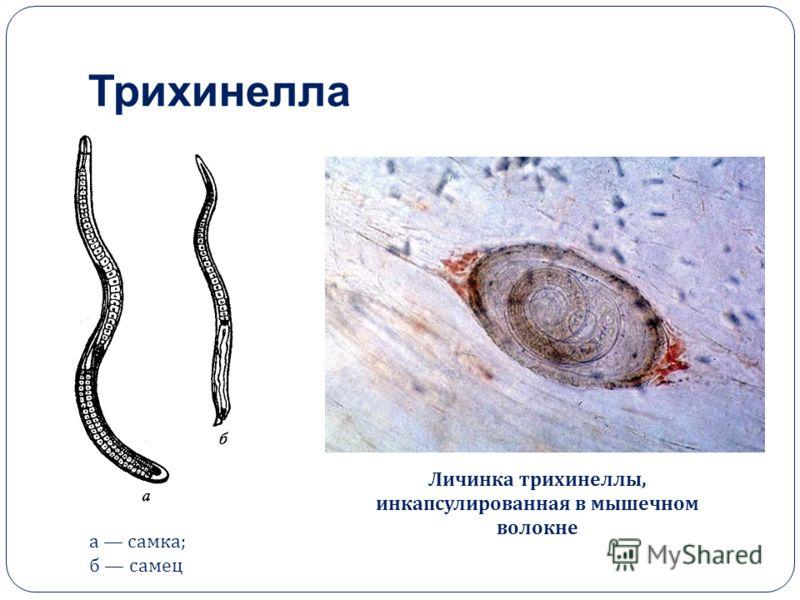 Цикл развития трихинеллы схема