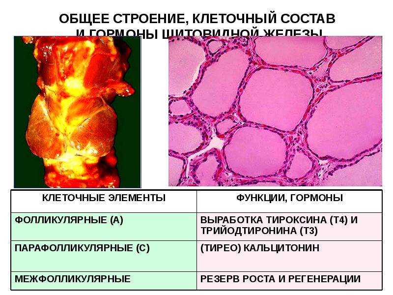 Установи рисунок на котором изображена железа вырабатывающая гормон тироксин