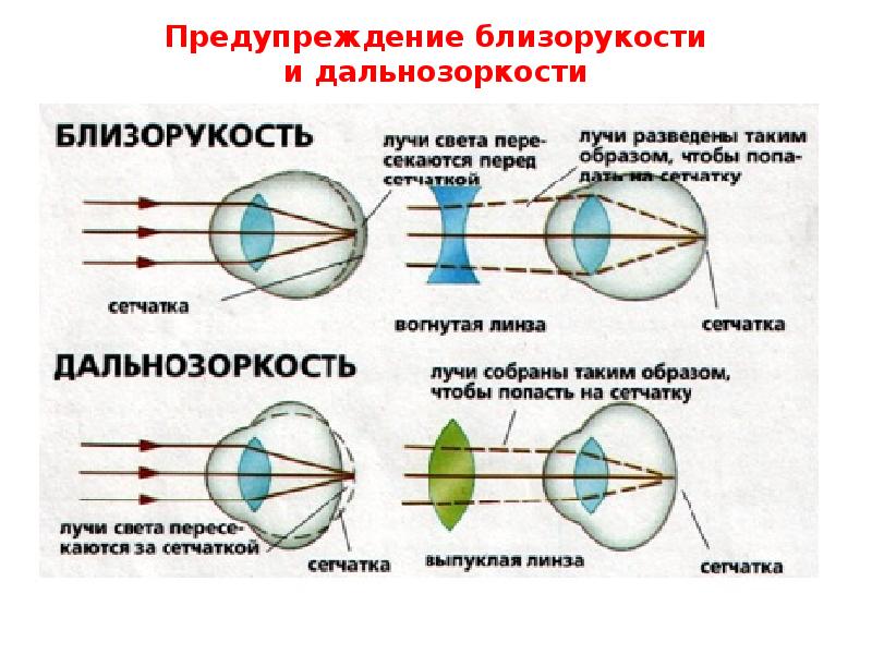 В какой части глазного яблока происходит фокусировка изображения у людей с нормальным зрением ответ